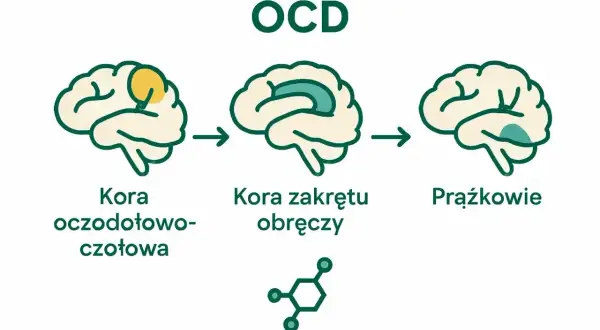 Schemat mózgu ilustrujący zmiany w obszarach kory przy OCD: czołowej, zakrętu obręczy i ciałach prążkowanych.