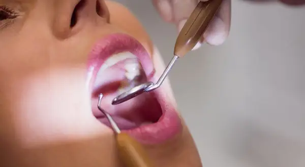 Badanie jamy ustnej, widoczna błona śluzowa i narzędzia dentystyczne.