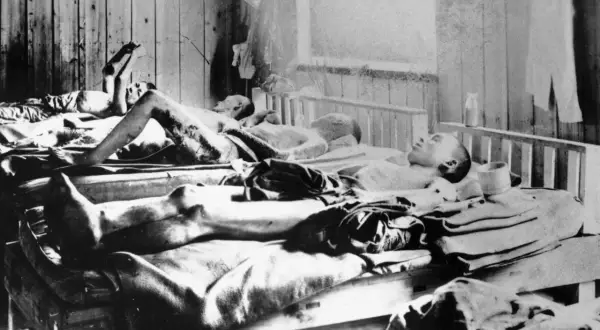 Ludzie poparzeni po katastrofie w Czarnobylu leżą na łóżkach szpitalnych, ich ciała noszą ślady obrażeń.