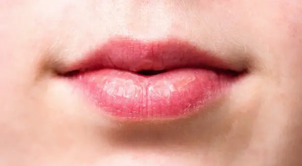 Nahaufnahme von Lippen. Trockene Lippen können ein Zeichen dafür sein, dass der Speichelfluss nachts angeregt werden muss.