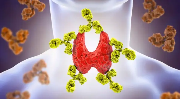 Tarczyca atakowana przez żółte przeciwciała, ilustracja chorób autoimmunologicznych.
