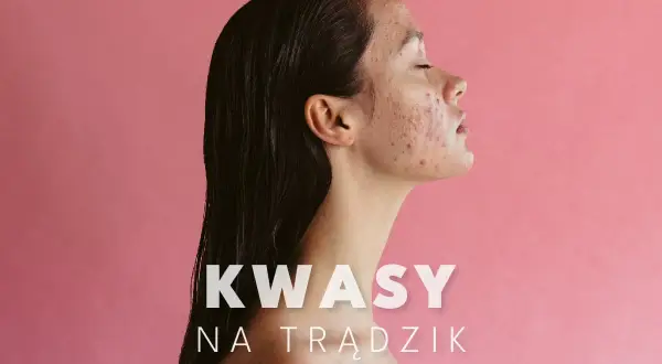 Kobieta z trądzikiem na twarzy, która odkrywa moc kwasów na trądzik.