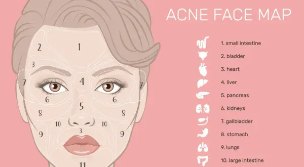 Mappa del viso per l'acne: la zona 3, intorno alla bocca, è collegata agli organi pelvici.