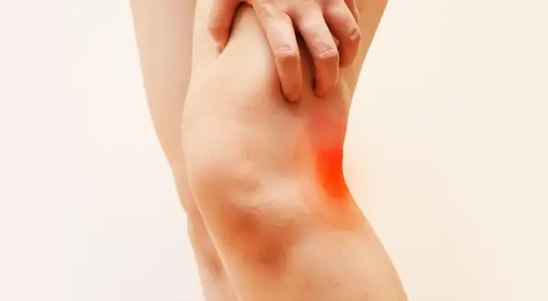 Dolore dietro al ginocchio dopo corsa, con un'area rossa che indica l'infiammazione.
