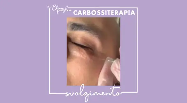 Close-up of a needle injecting into the under-eye area, with text overlay "CARBOSSITERAPIA".