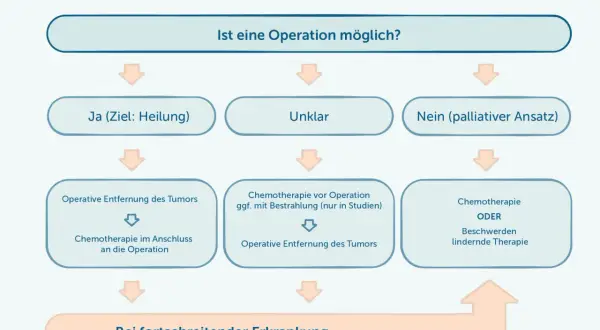 Flussdiagramm zur Behandlung eines **Tumors im Bauch** (Bauchspeicheldrüsenkrebs). Es zeigt Optionen wie Operation, Chemotherapie und palliative Therapie, je nach Heilungschancen.