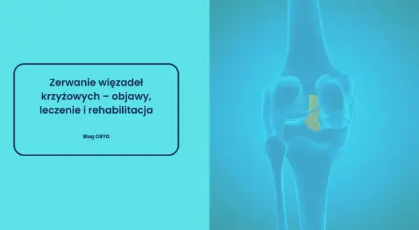 Ilustracja przedstawia zerwane więzadło krzyżowe w kolanie. Czy zerwane więzadło boli? Dowiedz się o objawach, leczeniu i rehabilitacji.