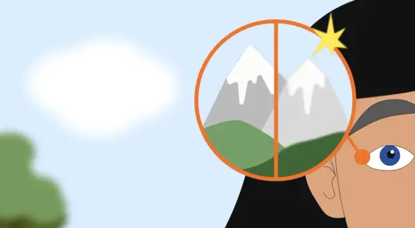 Occhi che osservano montagne, una sfocata, l'altra nitida, forse un problema al neurite ottica.