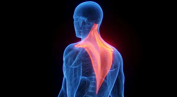 Vue anatomique du dos humain, mettant en évidence les muscles trapèzes en rouge vif, symbolisant la douleur trapeze.