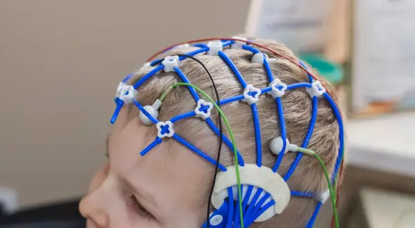 Barn med EEG-hjälm för utredning av adhd behandling.