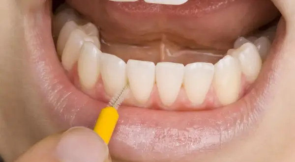 Un primo piano di denti bianchi e gengive sane, con un piccolo scovolino giallo che pulisce tra gli incisivi. La domanda è: il filo interdentale si passa prima o dopo lo spazzolino?