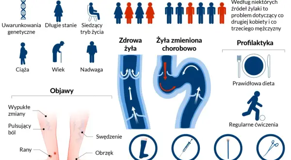 Ilustracja przedstawia czynniki ryzyka, objawy i profilaktykę żylaków, czyli przewlekłej niewydolności żylnej.