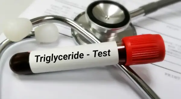 Probówka z krwią do badania trójglicerydów leży na stetoskopie. Wysokie trójglicerydy mogą wpływać na samopoczucie.