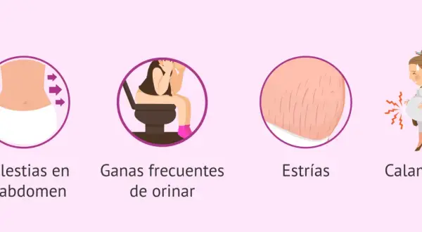 Ilustraciones de molestias comunes en **17 semanas de embarazo**: abdomen, ganas de orinar, estrías y calambres.