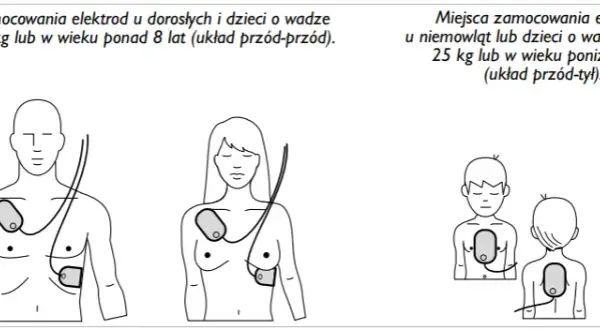 AED: Kiedy NIE używać? Sprawdź przeciwwskazania i mity