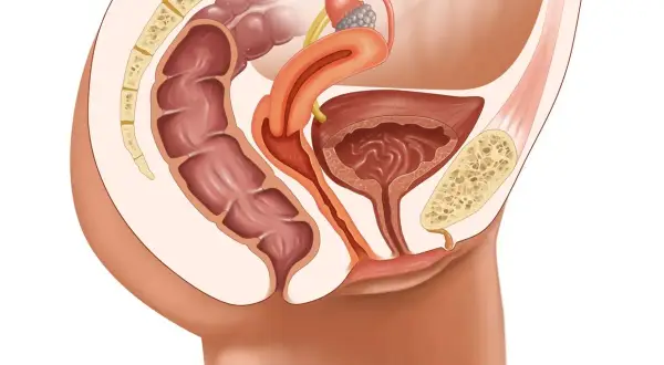 Illustration anatomique du pelvis féminin montrant le rectum, la vessie, l'utérus et les ligaments. Une condition comme le prolapsus vaginal peut affecter ces organes.