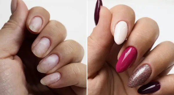 Przed i po: zniszczone paznokcie odzyskują piękno dzięki nadbudowie paznokcia żelem. Efekt: elegancki manicure w odcieniach śliwki, różu i bieli.