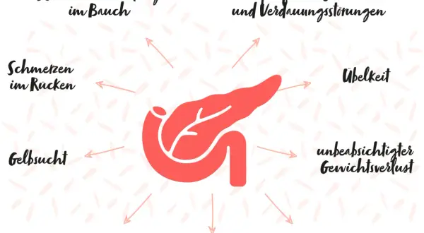Symptome bei Bauchspeicheldrüsenkrebs: Wasseransammlung im Bauch, Rückenschmerzen, Gelbsucht, heller Stuhl, Appetitmangel, Oberbauchschmerzen, Übelkeit, unbeabsichtigter Gewichtsverlust.