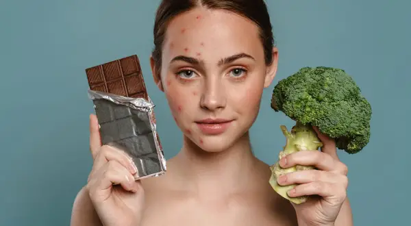 Frau mit Pickeln hält Schokolade und Brokkoli. Welche Lebensmittel helfen gegen Pickel? Brokkoli ist gesund, Schokolade oft nicht.