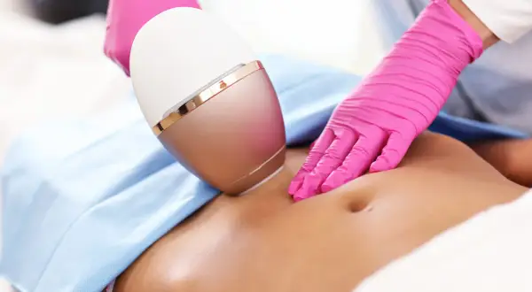 Depilacja laserowa bikini: Jak przebiega zabieg? Krok po kroku