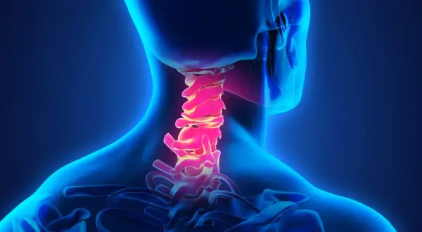 Colonna vertebrale cervicale illuminata in rosso, suggerendo cervicalgia e vertigini.