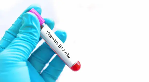 Guanto blu tiene provetta con etichetta "Vitamina B12 Alta". Risultato di analisi del sangue.