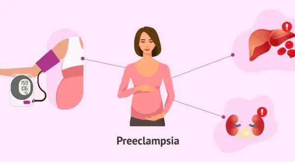 Ilustración de una mujer embarazada con un tensiómetro, hígado y riñones, mostrando los **preeclampsia riesgos** y sus efectos.