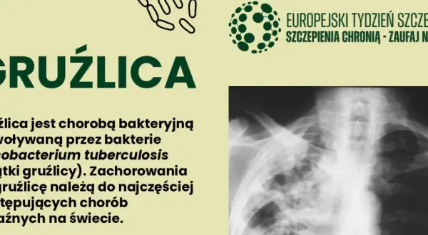 Gruźlica to choroba bakteryjna. Na zdjęciu RTG klatki piersiowej widoczne są zmiany typowe dla gruźlicy.