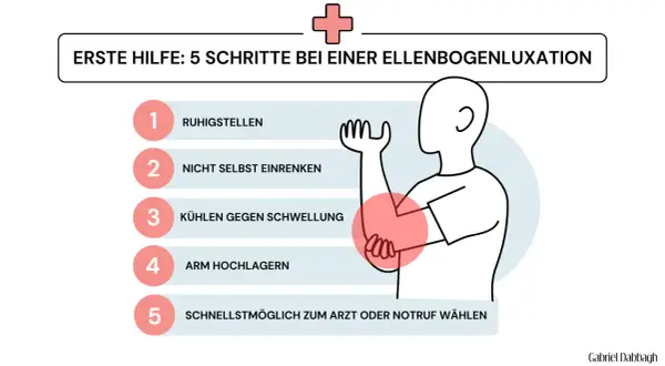 Erste Hilfe bei einem ellenbogen ausgekugelt: Ruhigstellen, nicht selbst einrenken, kühlen, Arm hochlagern, Arzt rufen.