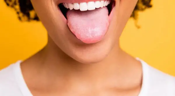 Bocca aperta con lingua rosa che sporge, un po' di bianco si nota, forse perchè ho la lingua bianca. Sorriso smagliante su sfondo giallo.