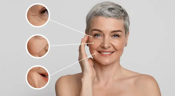 Mujer sonriente con piel madura. Se muestran primeros planos de arrugas en ojos, mejillas y boca, sugiriendo tratamientos para quitar arrugas frente y otras zonas.