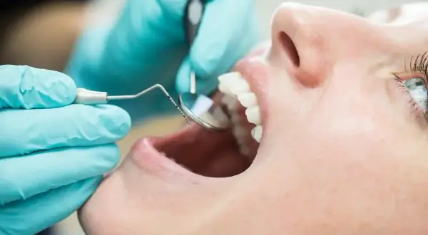 Dentysta bada zęby pacjentki, oceniając przeciwwskazania do lakierowania.