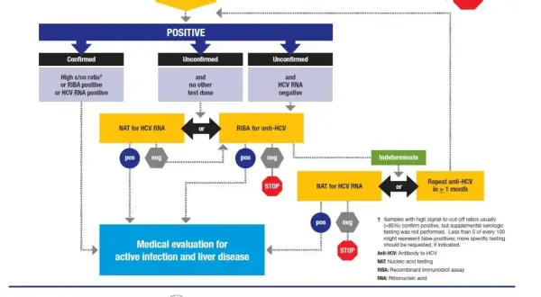 Schemat diagnostyki zakażenia HCV: od testu Anti-HCV, przez wyniki pozytywne, niepotwierdzone, do oceny medycznej. Dowiedz się, hcv co to.