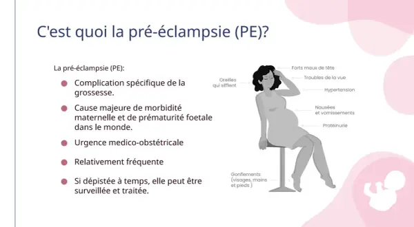 Illustration expliquant la pré-éclampsie et ses symptômes : maux de tête, troubles de la vue, hypertension, nausées, vomissements, protéinurie, sifflements d'oreilles et gonflements.