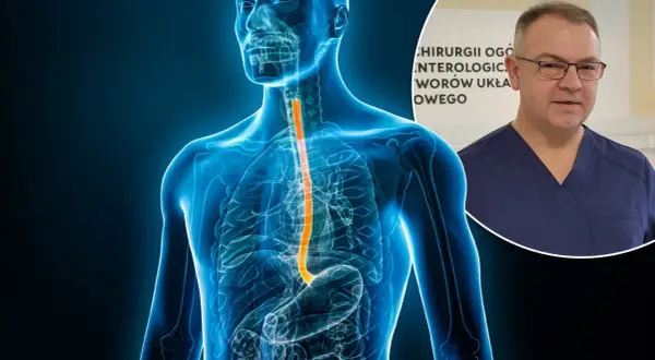 Anatomia przełyku z zaznaczonym obszarem, który może wskazywać na raka przełyku objawy. Obok lekarz w granatowym uniformie.