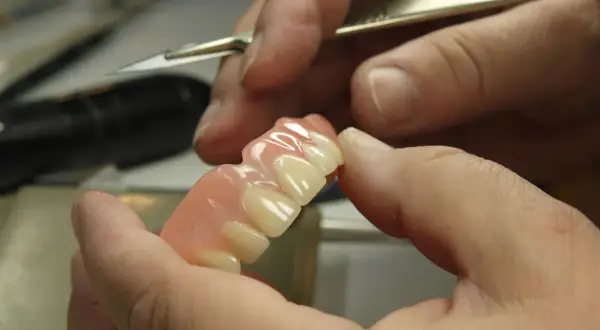 Dłoń trzyma protezę na implantach NFZ, gotową do dopasowania.