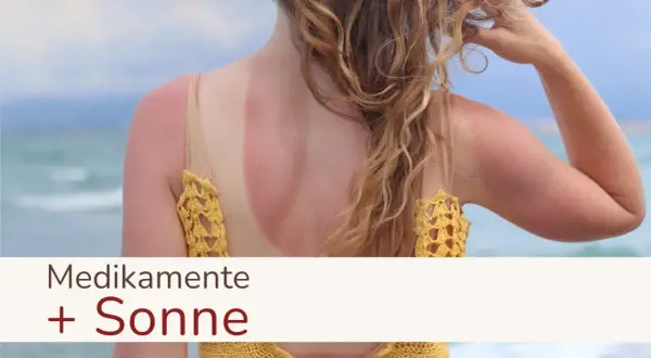 Sonnenbrand am Rücken einer Frau, die Medikamente einnimmt. Vorsicht bei Antibiotika und Sonne!