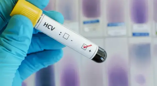 Ile kosztuje badanie HCV? Ceny, które mogą cię zaskoczyć