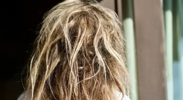 Widok z tyłu na blond włosy z widocznymi kołtunami. To nie jest choroba, ale efekt braku pielęgnacji.