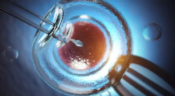 Sperm wstrzykiwany do komórki jajowej. Zastanawiasz się, ile kosztuje in vitro?