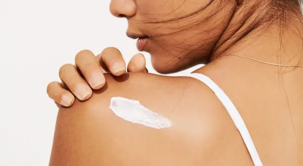 Eine Hand trägt eine weiße Creme auf die Schulter auf. Die Creme könnte Panthenol oder Bepanthen enthalten, um die Haut zu pflegen.