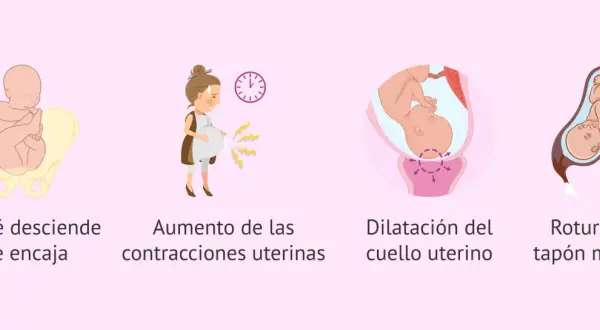 Ilustración de las etapas del parto normal: bebé encajado, contracciones, dilatación y rotura del tapón mucoso.