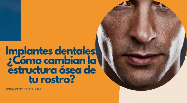 Primer plano de un rostro masculino con texto que pregunta cómo los implantes dentales cambian la estructura ósea.