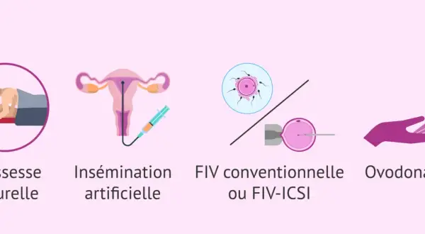 Illustrations de différentes méthodes pour concevoir un enfant, de la grossesse naturelle à l'ovodonation, utiles pour les femmes atteintes d'endométriose.