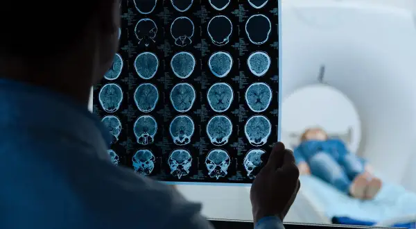 Lekarz analizuje wyniki rezonansu magnetycznego głowy bez kontrastu, szukając powikłań. W tle pacjent leży w aparacie MRI.
