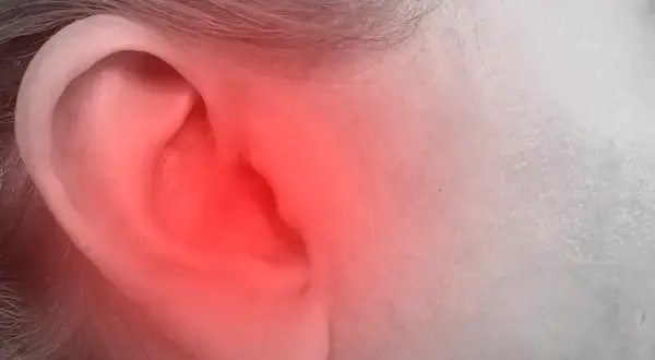 Czerwony rumień na uchu, obejmujący helix, sugeruje ból lub stan zapalny.