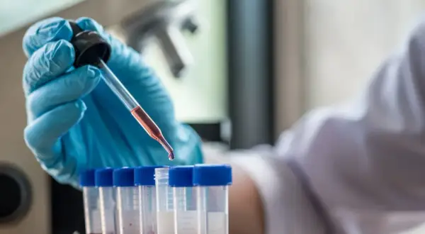 Ręka w niebieskiej rękawiczce pobiera próbkę krwi do analizy. Badanie HIV cena jest kluczowa dla szybkiej diagnostyki.
