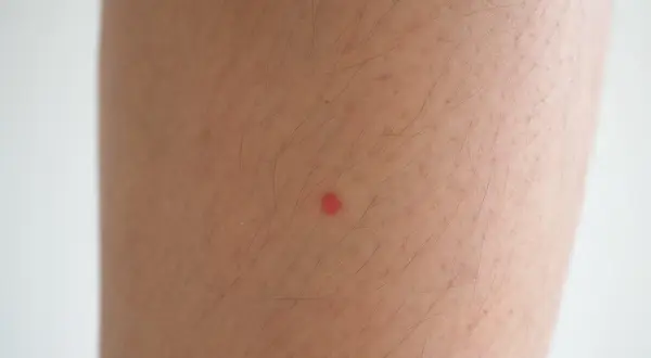 Una pequeña mancha roja en la pierna, quizás una picadura de insecto, resalta sobre la piel con vello.
