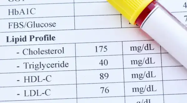 Wynik lipidogramu: cholesterol 175 mg/dL, HDL 89 mg/dL, LDL 76 mg/dL. Sprawdzam, czy cholesterol nie-HDL mieści się w normie.