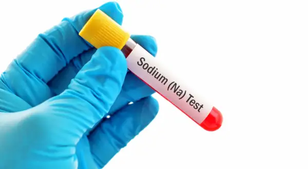 Mano con guanto blu tiene provetta con etichetta "Sodium (Na) Test", per verificare i sodio valori normali.